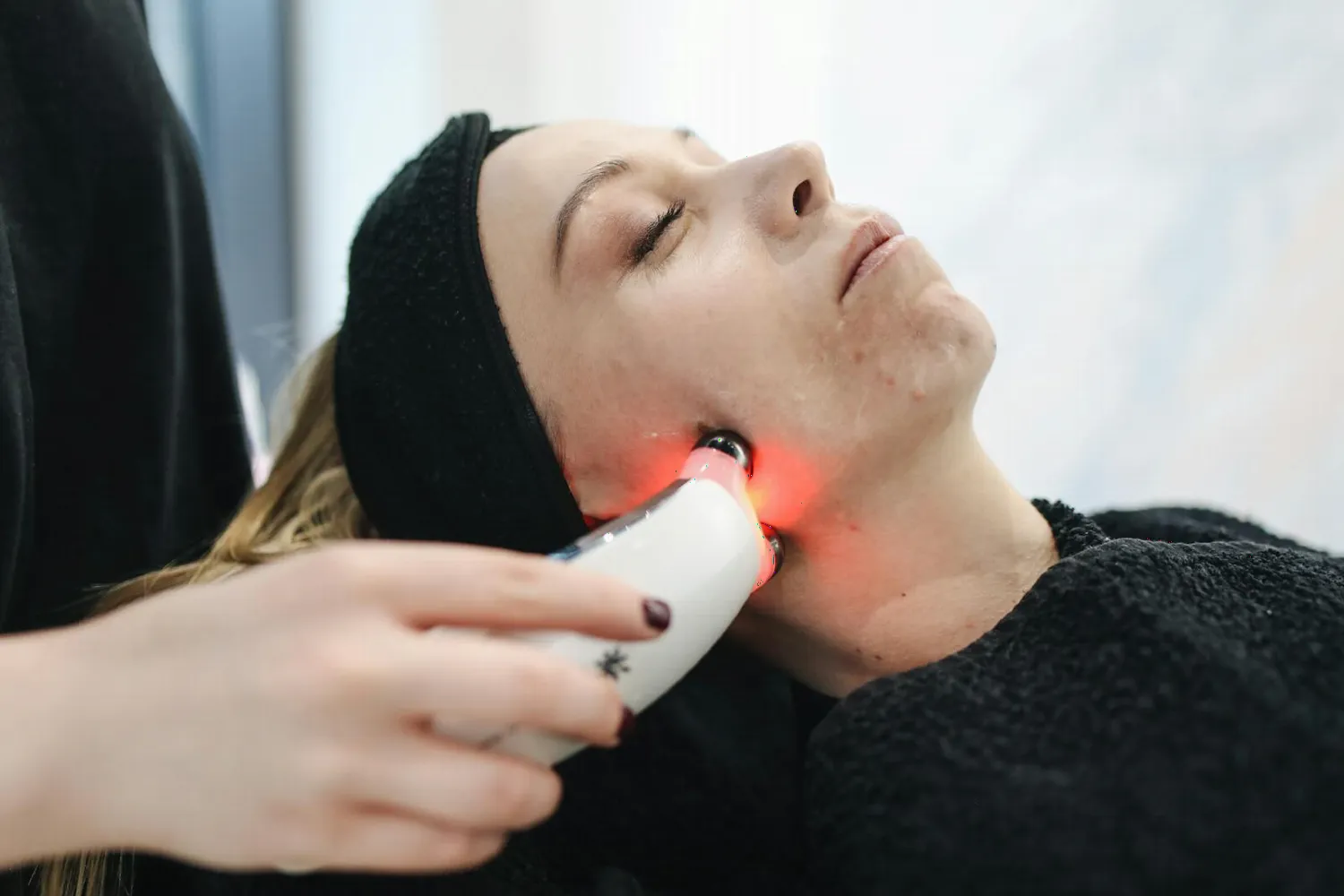 Thermage radiofrequency skin tightening treatment