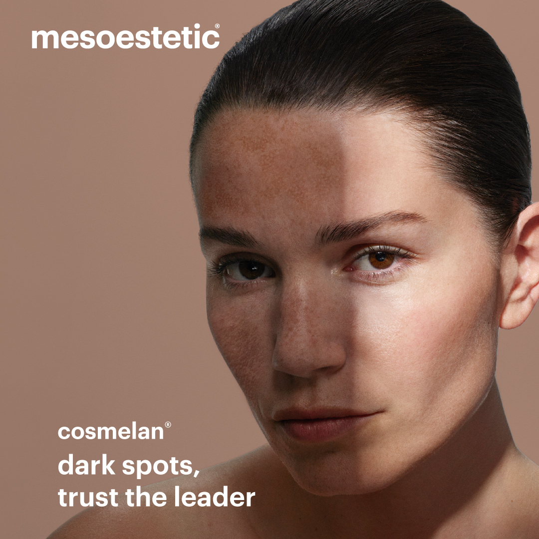 Cosmelan treatment consultation at Avesa Health