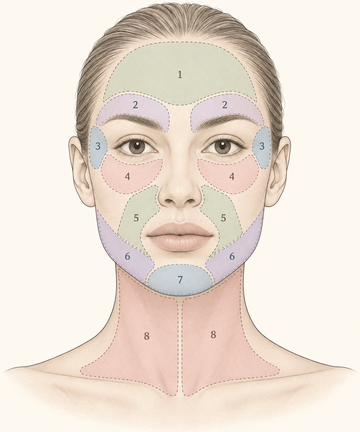 Illustrated Plamere face and neck treatment map